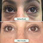 Pryah EyeRenew™ Under-Eye Red Light Therapy
